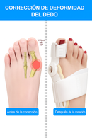 Férula Correctora de Juanete | Alivio para Hallux Valgus | 1 Unidad